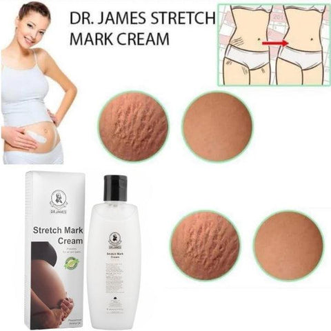 Dr James Stretch Mark Cream 200ml