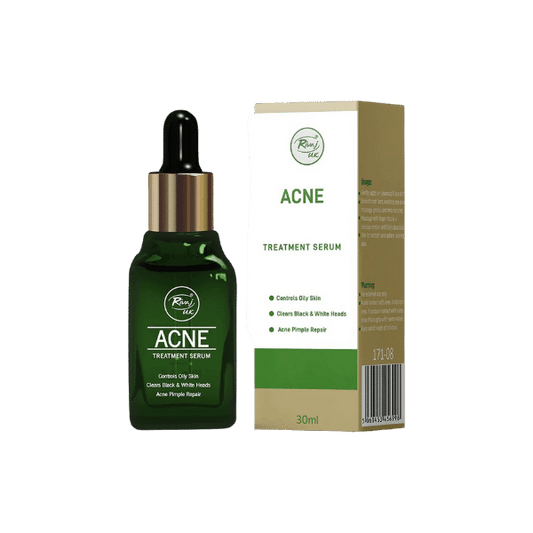 RIVAJ UK ACNE TREATMENT SERUM 30ML - Nazar Jan's Supermarket